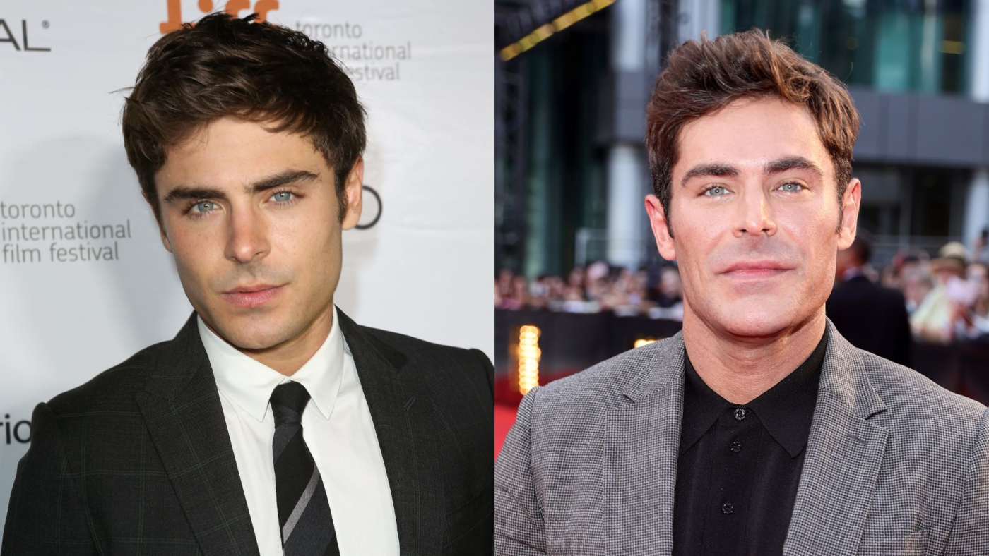 Zac Efron's face before and after his accident in 2013